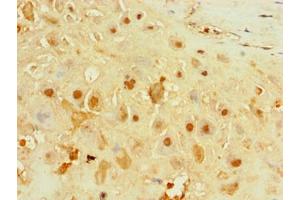 Immunohistochemistry of paraffin-embedded human placenta tissue using ABIN7156651 at dilution of 1:100 (IFIH1 抗体  (AA 700-1025))