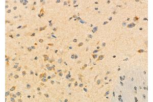 ABIN6260084 and ABIN6273196 at 1/100 staining Mouse brain tissue by IHC-P. (ASRGL1 抗体  (Internal Region))