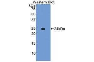Western blot analysis of the recombinant protein. (Chemokine (C-X-C Motif) Ligand 15 (CXCL15) (AA 26-167) 抗体)