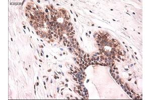 Immunohistochemical staining of paraffin-embedded breast using anti-KRT18 (ABIN2452674) mouse monoclonal antibody. (Cytokeratin 18 抗体  (AA 69-372))