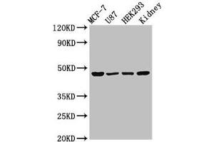 Western Blot Positive WB detected in: MCF-7 whole cell lysate, U87 whole cell lysate, HEK293 whole cell lysate, Rat kidney tissue All lanes: WWOX antibody at 3 μg/mL Secondary Goat polyclonal to rabbit IgG at 1/50000 dilution Predicted band size: 47, 42, 22, 5, 27, 36, 24 kDa Observed band size: 47 kDa