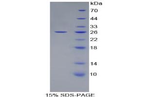 SDS-PAGE analysis of Rat ATF4 Protein. (ATF4 蛋白)