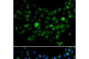 Immunofluorescence analysis of A549 cells using MCM10 Polyclonal Antibody (MCM10 抗体)