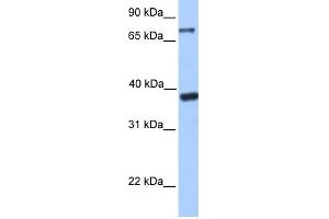 WB Suggested Anti-DIDO1 Antibody Titration:  0. (DIDO1 抗体  (C-Term))