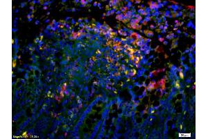 Formalin-fixed and paraffin-embedded mouse intestine labeled with Anti-Complement C4/C4 Polyclonal Antibody, Unconjugated (ABIN1385186) 1:200, overnight at 4°C, The secondary antibody was Goat Anti-Rabbit IgG, Cy3 conjugated used at 1:200 dilution for 40 minutes at 37°C. (Complement C4 抗体  (AA 701-800))