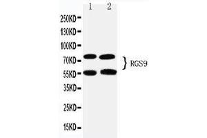 Anti-RGS9 antibody, Western blotting Lane 1: Rat Brain Tissue Lysate Lane 2: Mouse Brain Tissue Lysate (RGS 抗体  (C-Term))