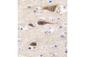 Formalin-fixed and paraffin-embedded human brain tissue reacted with CYP2R1 antibody , which was peroxidase-conjugated to the secondary antibody, followed by DAB staining. (CYP2R1 抗体  (AA 152-180))