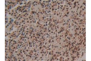 Immunohistochemistry (IHC) image for anti-S100 Calcium Binding Protein P (S100P) (AA 1-95) antibody (ABIN7434620)