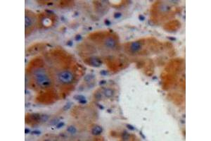IHC-P analysis of Liver tissue, with DAB staining. (Clusterin 抗体  (AA 227-447))