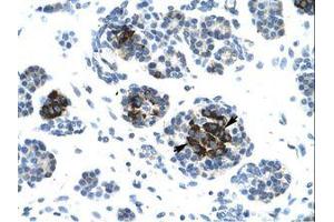 Image no. 1 for anti-Ligase IV, DNA, ATP-Dependent (LIG4) (AA 275-324) antibody (ABIN202951) (LIG4 抗体  (AA 275-324))