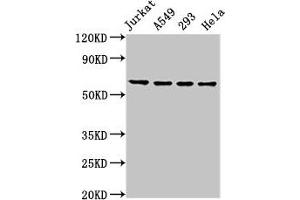Western Blot Positive WB detected in: Jurkat whole cell lysate, A549 whole cell lysate, 293 whole cell lysate, Hela whole cell lysate All lanes: TAF15 antibody at 8. (TAF15 抗体  (AA 93-206))