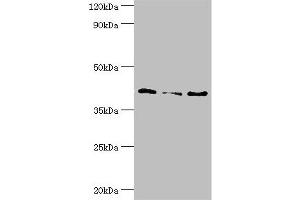Western blot All lanes: Serpin B5 antibody at 10 μg/mL Lane 1: HepG2 whole cell lysate Lane 2: Hela whole cell lysate Lane 3: A431 whole cell lysate Secondary Goat polyclonal to rabbit IgG at 1/10000 dilution Predicted band size: 43, 26 kDa Observed band size: 43 kDa