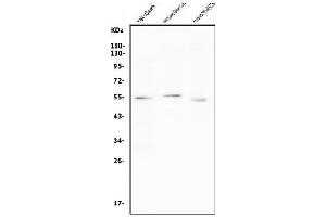 Western blot analysis of CCNB1 using anti-CCNB1 antibody (ABIN7599335).