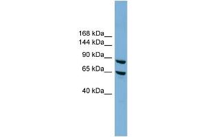 WB Suggested Anti-EXOC6 Antibody Titration: 0. (EXOC6 抗体  (N-Term))