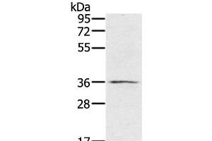 Western Blot analysis of TM4 cell using p53RFP Polyclonal Antibody at dilution of 1:400 (RNF144B 抗体)