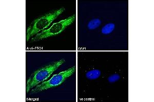 Immunofluorescence (IF) image for anti-Patched 1 (PTCH1) (C-Term) antibody (ABIN185521)