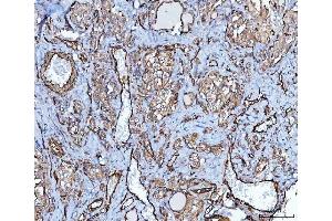 IHC analysis of PTRF/CAVIN1 using anti-PTRF/CAVIN1 antibody (ABIN7601817). (PTRF 抗体  (AA 47-390))