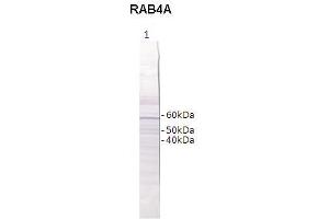 Western Blotting (WB) image for anti-RAB4B, Member RAS Oncogene Family (RAB4B) (Middle Region) antibody (ABIN2788152) (RAB4B 抗体  (Middle Region))