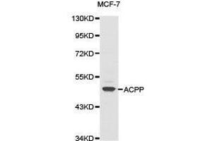 Western Blotting (WB) image for anti-Acid Phosphatase, Prostate (ACPP) antibody (ABIN1870774) (ACPP 抗体)