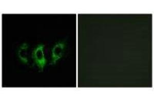 Immunofluorescence analysis of A549 cells, using GFM2 antibody. (GFM2 抗体)