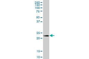 PRDX3 MaxPab polyclonal antibody. (Peroxiredoxin 3 抗体  (AA 1-256))
