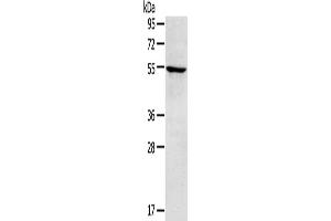 Gel: 8 % SDS-PAGE, Lysate: 40 μg, Lane: A172 cells, Primary antibody: ABIN7192889(TRIM22 Antibody) at dilution 1/250, Secondary antibody: Goat anti rabbit IgG at 1/8000 dilution, Exposure time: 3 minutes (TRIM22 抗体)