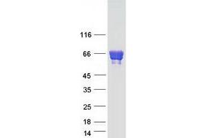 Validation with Western Blot