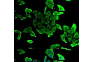 Immunofluorescence analysis of U2OS cells using SGCD Polyclonal Antibody (SGCD 抗体)
