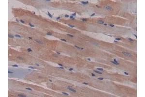 DAB staining on IHC-P; Samples: Rat Heart Tissue (CCL9 抗体  (AA 27-117))