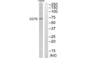 Western blot analysis of extracts from HepG2 cells, using CCT5 antibody. (CCT5 抗体  (Internal Region))
