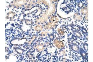 EMG1 antibody was used for immunohistochemistry at a concentration of 4-8 ug/ml to stain Epithelial cells of renal tubule (arrows) in Human Kidney. (EMG1 抗体)