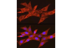 Immunofluorescence analysis of NIH/3T3 cells using CSNK2 Rabbit pAb (ABIN3022252, ABIN3022253, ABIN3022254 and ABIN6218695) at dilution of 1:100 (40x lens). (CSNK2A2 抗体  (AA 1-350))