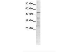 Image no. 1 for anti-Acetylcholine Receptor Subunit alpha (CHRNA1) (AA 25-74) antibody (ABIN6735455) (CHRNA1 抗体  (AA 25-74))