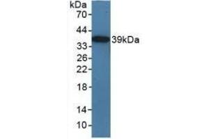 Detection of Recombinant TICAM1, Mouse using Polyclonal Antibody to Toll Like Receptor Adaptor Molecule 1 (TICAM1) (TICAM1 抗体  (AA 263-526))