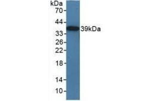 Detection of Recombinant TICAM1, Mouse using Polyclonal Antibody to Toll Like Receptor Adaptor Molecule 1 (TICAM1)