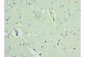 Immunohistochemistry of paraffin-embedded human brain tissue using ABIN7143053 at dilution of 1:100