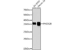 Western blot analysis of extracts of various cell lines, using PHOX2B Rabbit mAb (ABIN7269159) at 1:1000 dilution. (PHOX2B 抗体)
