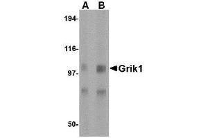 Western blot analysis of Grik1 in rat brain tissue lysate with AP30381PU-N Grik1 antibody at (A) 0. (GRIK1 抗体  (Center))