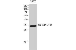 Western Blotting (WB) image for anti-Heterogeneous Nuclear Ribonucleoprotein C (C1/C2) (HNRNPC) (Ser484) antibody (ABIN3185059) (HNRNPC 抗体  (Ser484))