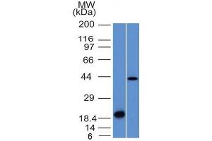 Western Blot Analysis (A) Recombinant Protein (B) Human Liver lysate Aurora B Mouse Monoclonal Antibody (AURKB/1521).