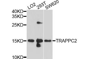 Western blot analysis of extracts of various cell lines, using TRAPPC2 antibody (ABIN4905483) at 1:1000 dilution. (TRAPPC2 抗体)