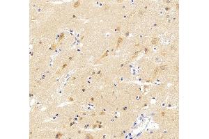 IHC analysis of SRGAP3 using anti-SRGAP3 antibody (ABIN7602538).