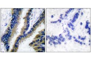 Immunohistochemistry (IHC) image for anti-Vav 1 Oncogene (VAV1) (Tyr174) antibody (ABIN1848166)