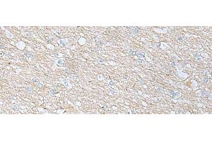 Immunohistochemistry of paraffin-embedded Human brain tissue using BDNF Polyclonal Antibody at dilution of 1:65(x200)