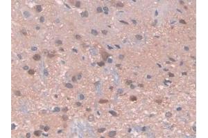 Detection of PDXK in Rat Spinal cord Tissue using Polyclonal Antibody to Pyridoxal Kinase (PDXK) (PDXK 抗体  (AA 35-251))