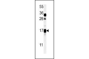 CSAG2 Antibody (N-term) (ABIN651616 and ABIN2840327) western blot analysis in ZR-75-1 cell line lysates (35 μg/lane). (CSAG2 抗体  (N-Term))