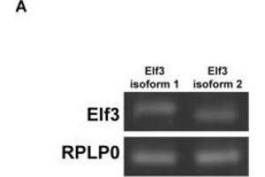 Elf3 overexpression enhanced basal and vasopressin-induced AQP2 promoter activity and transcription. (ELF3 抗体  (AA 1-280))