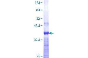 CDX1 Protein (AA 126-215) (GST tag)