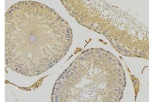 ABIN6279276 at 1/100 staining RAT testis tissue by IHC-P. (CEP41 抗体  (Internal Region))