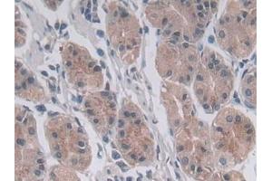 Detection of MTHFR in Human Stomach Tissue using Polyclonal Antibody to Methylenetetrahydrofolate Reductase (MTHFR) (MTHFR 抗体  (AA 1-325))